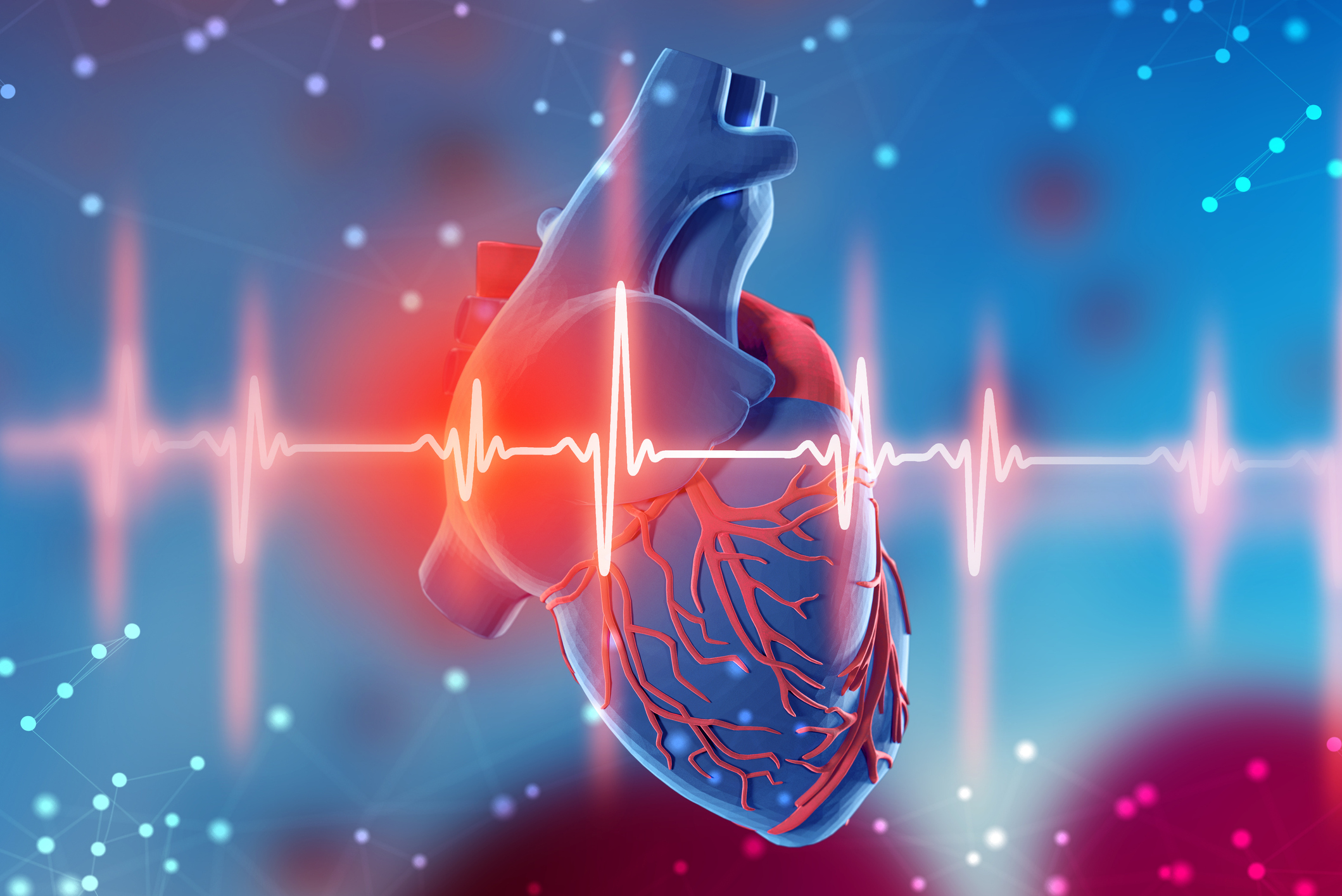 Heart Attack