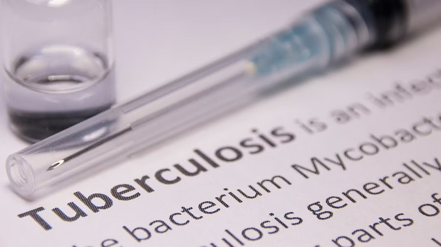 Shortage of tuberculosis drugs