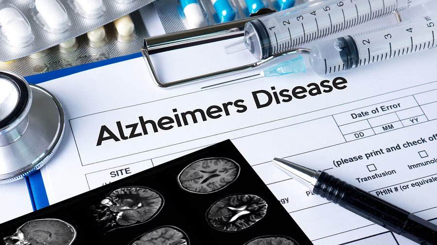 World Alzheimers Month celebrations in city today