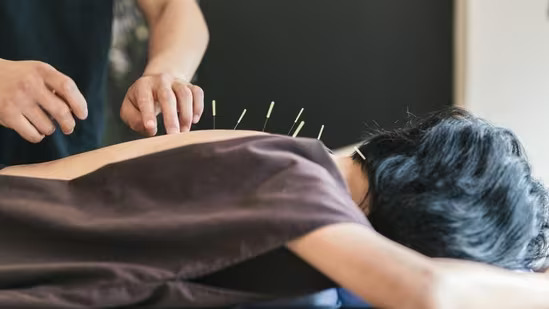 Acupuncture can help with many different types of chronic pain